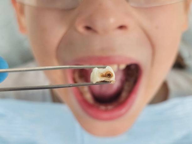 Best Mobile Emergency Dentist in Lakesite, TN
